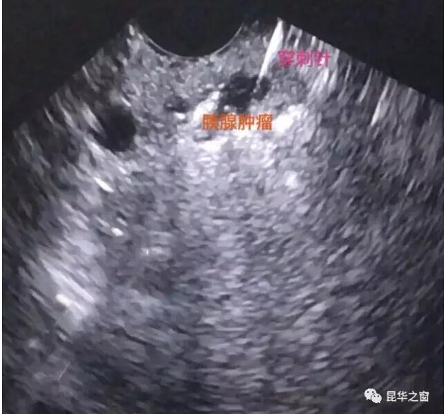 QQ截图20170814184018.jpg